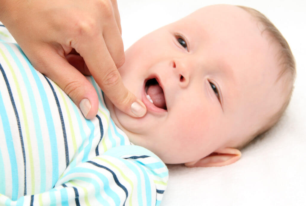 how to treat a childs tongue tie