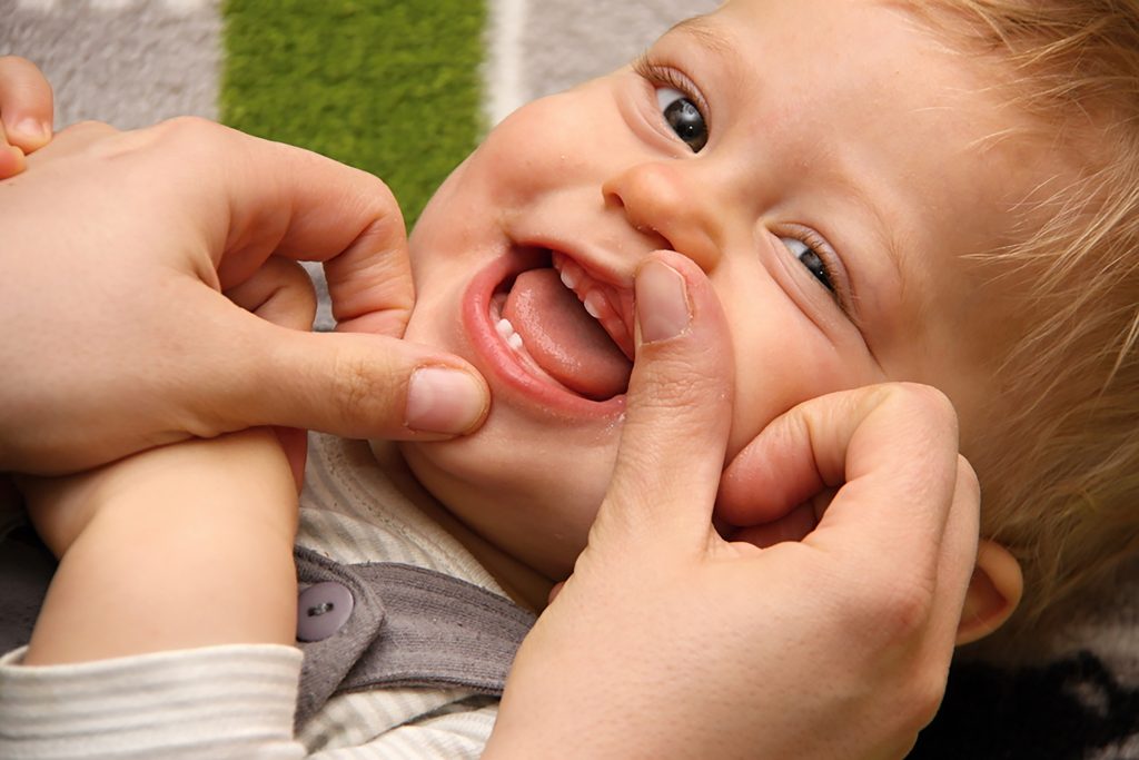 should an infants lip tie be treated