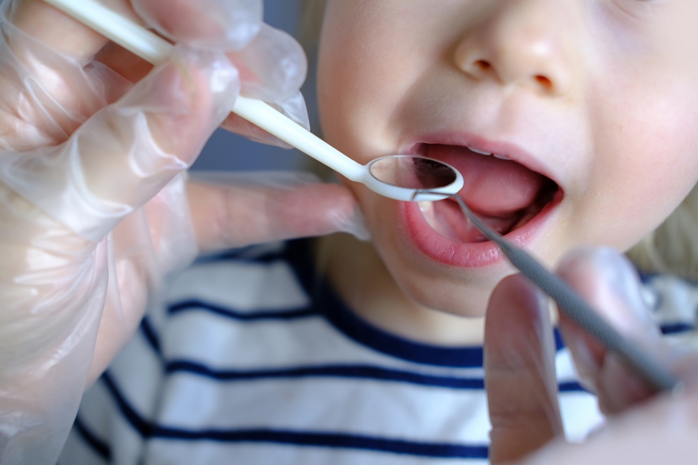 how to care for your childs mouth after getting tongue tie surgery