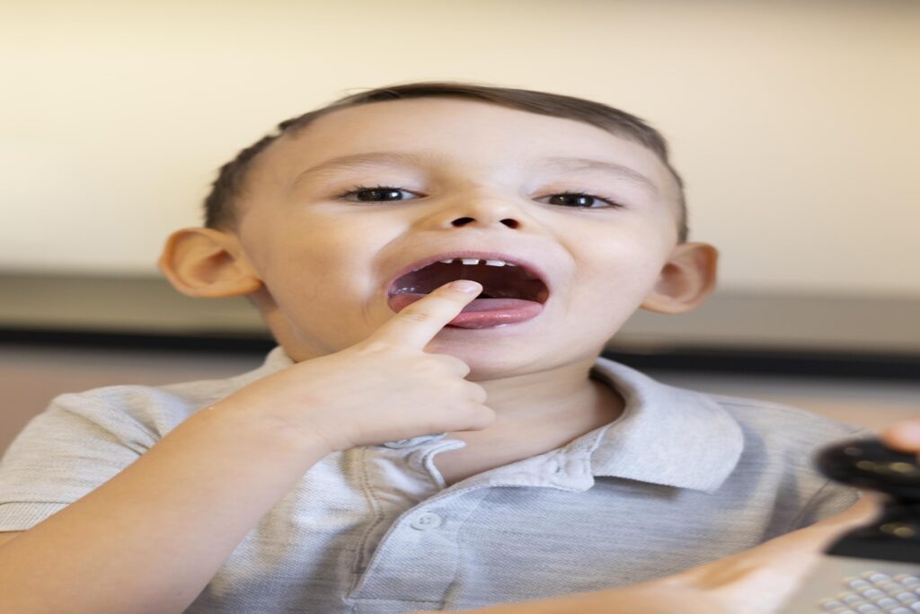 How Lip Tie Affects Speech in Your Children